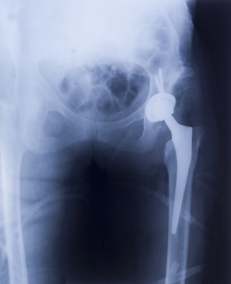 Biomedical Engineer